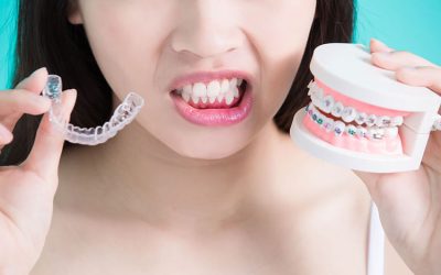 Braces vs. Invisalign®: Which is Best for You?