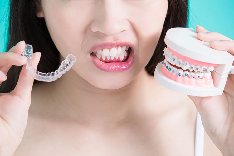 Braces vs. Invisalign®: Which is Best for You?